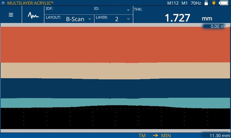 B-Scan: Ultrasonic b-scan